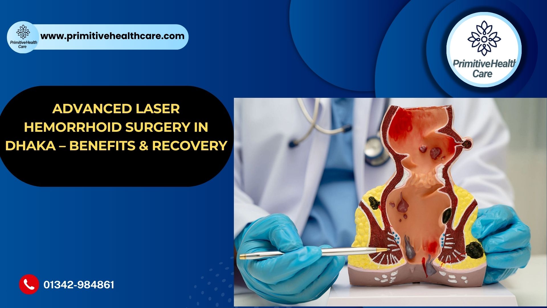 Advanced Laser Hemorrhoid Surgery in Dhaka – Benefits & Recovery